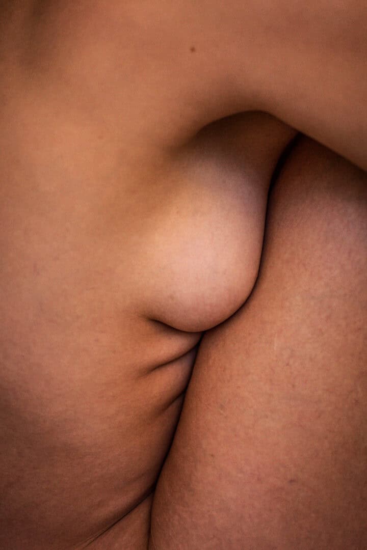 Breast Reconstruction